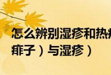 怎么辨别湿疹和热疹子（如何正确辨别热疹（痱子）与湿疹）
