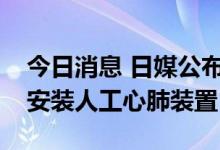 今日消息 日媒公布安倍最新伤情：院方考虑安装人工心肺装置