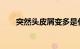 突然头皮屑变多是什么原因知识介绍
