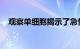 观察单细胞揭示了急性肾损伤的关键过程