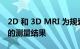2D 和 3D MRI 为规划 ACL 手术提供了可靠的测量结果